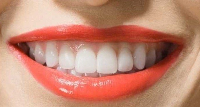 Diş Kanaması Nedenleri